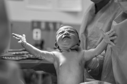 Picture of newborn baby with arms out